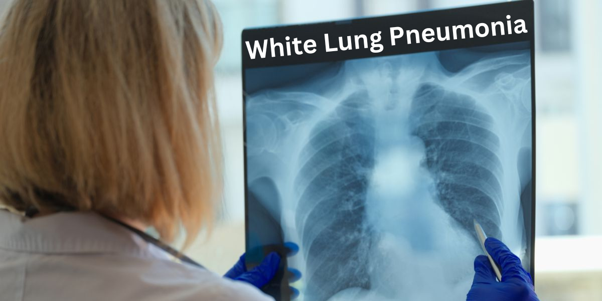White Lung Pneumonia: Causes, Symptoms, and Treatment